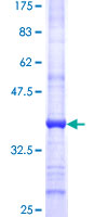 SMARCAL1 Protein - 12.5% SDS-PAGE Stained with Coomassie Blue.