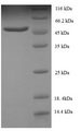 SMARCB1 / INI1 Protein - (Tris-Glycine gel) Discontinuous SDS-PAGE (reduced) with 5% enrichment gel and 15% separation gel.