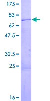 SMARCB1 / INI1 Protein - 12.5% SDS-PAGE of human SMARCB1 stained with Coomassie Blue
