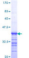 SMARCB1 / INI1 Protein - 12.5% SDS-PAGE Stained with Coomassie Blue.