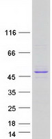 SMARCB1 / INI1 Protein - Purified recombinant protein SMARCB1 was analyzed by SDS-PAGE gel and Coomassie Blue Staining