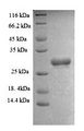 SMARCC1 / SWI3 Protein - (Tris-Glycine gel) Discontinuous SDS-PAGE (reduced) with 5% enrichment gel and 15% separation gel.
