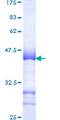 SMARCC1 / SWI3 Protein - 12.5% SDS-PAGE Stained with Coomassie Blue.