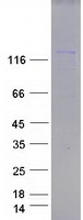 SMARCC1 / SWI3 Protein - Purified recombinant protein SMARCC1 was analyzed by SDS-PAGE gel and Coomassie Blue Staining