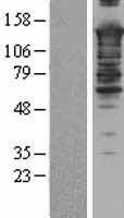 SMARCC2 Protein - Western validation with an anti-DDK antibody * L: Control HEK293 lysate R: Over-expression lysate