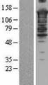 SMARCC2 Protein - Western validation with an anti-DDK antibody * L: Control HEK293 lysate R: Over-expression lysate