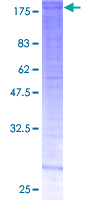 SMARCC2 Protein - 12.5% SDS-PAGE of human SMARCC2 stained with Coomassie Blue