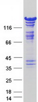 SMARCC2 Protein - Purified recombinant protein SMARCC2 was analyzed by SDS-PAGE gel and Coomassie Blue Staining