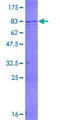 SMARCD1 / BAF60A Protein - 12.5% SDS-PAGE of human SMARCD1 stained with Coomassie Blue