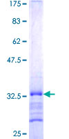 SMARCD1 / BAF60A Protein - 12.5% SDS-PAGE Stained with Coomassie Blue.