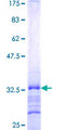 SMARCD1 / BAF60A Protein - 12.5% SDS-PAGE Stained with Coomassie Blue.