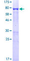 SMARCE1 / BAF57 Protein - 12.5% SDS-PAGE of human SMARCE1 stained with Coomassie Blue
