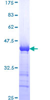 SMC1A / SMC1 Protein - 12.5% SDS-PAGE Stained with Coomassie Blue.