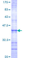 SMC1B Protein - 12.5% SDS-PAGE Stained with Coomassie Blue