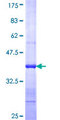 SMC2 Protein - 12.5% SDS-PAGE Stained with Coomassie Blue.