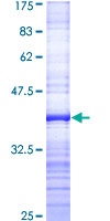 SMC3 / HCAP Protein - 12.5% SDS-PAGE Stained with Coomassie Blue.