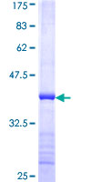 SMC4 Protein - 12.5% SDS-PAGE Stained with Coomassie Blue.