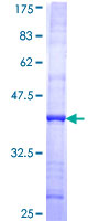 SMC5 Protein - 12.5% SDS-PAGE Stained with Coomassie Blue.