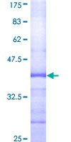 SMC6 Protein - 12.5% SDS-PAGE Stained with Coomassie Blue.
