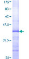 SMC6 Protein - 12.5% SDS-PAGE Stained with Coomassie Blue.