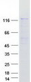 SMC6 Protein - Purified recombinant protein SMC6 was analyzed by SDS-PAGE gel and Coomassie Blue Staining