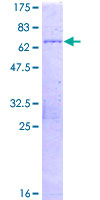 SMCHD1 Protein - 12.5% SDS-PAGE of human SMCHD1 stained with Coomassie Blue