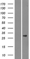 SMCO3 Protein - Western validation with an anti-DDK antibody * L: Control HEK293 lysate R: Over-expression lysate