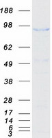 SMEK1 Protein - Purified recombinant protein SMEK1 was analyzed by SDS-PAGE gel and Coomassie Blue Staining