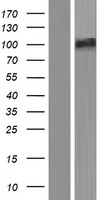 SMEK2 Protein - Western validation with an anti-DDK antibody * L: Control HEK293 lysate R: Over-expression lysate