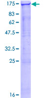 SMG5 Protein - 12.5% SDS-PAGE of human SMG5 stained with Coomassie Blue