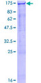 SMG5 Protein - 12.5% SDS-PAGE of human SMG5 stained with Coomassie Blue