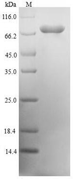 SMIF / DCP1A Protein - (Tris-Glycine gel) Discontinuous SDS-PAGE (reduced) with 5% enrichment gel and 15% separation gel.