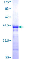 SMIF / DCP1A Protein - 12.5% SDS-PAGE Stained with Coomassie Blue.