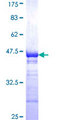 SMIF / DCP1A Protein - 12.5% SDS-PAGE Stained with Coomassie Blue.
