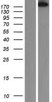 SMMHC / MYH11 Protein - Western validation with an anti-DDK antibody * L: Control HEK293 lysate R: Over-expression lysate