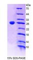 SMMHC / MYH11 Protein - Recombinant Myosin Heavy Chain 11, Smooth Muscle (MYH11) by SDS-PAGE