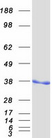 SMN1 Protein - Purified recombinant protein SMN1 was analyzed by SDS-PAGE gel and Coomassie Blue Staining