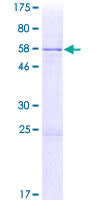 SMN2 Protein - 12.5% SDS-PAGE of human SMN2 stained with Coomassie Blue