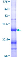 SMN2 Protein - 12.5% SDS-PAGE Stained with Coomassie Blue.