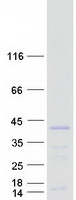 SMN2 Protein - Purified recombinant protein SMN2 was analyzed by SDS-PAGE gel and Coomassie Blue Staining