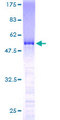 SMNDC1 Protein - 12.5% SDS-PAGE of human SMNDC1 stained with Coomassie Blue