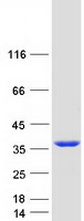 SMNDC1 Protein - Purified recombinant protein SMNDC1 was analyzed by SDS-PAGE gel and Coomassie Blue Staining