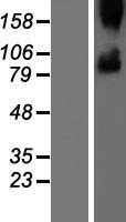 SMO / Smoothened Protein - Western validation with an anti-DDK antibody * L: Control HEK293 lysate R: Over-expression lysate