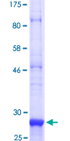 SMO / Smoothened Protein - 12.5% SDS-PAGE Stained with Coomassie Blue.