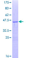 SMO / Smoothened Protein - 12.5% SDS-PAGE Stained with Coomassie Blue.