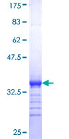 SMOC1 Protein - 12.5% SDS-PAGE Stained with Coomassie Blue.