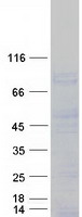SMOC1 Protein - Purified recombinant protein SMOC1 was analyzed by SDS-PAGE gel and Coomassie Blue Staining