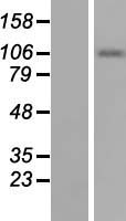 Smoothelin Protein - Western validation with an anti-DDK antibody * L: Control HEK293 lysate R: Over-expression lysate
