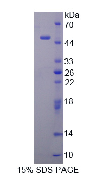 Smoothelin Protein - Recombinant Smoothelin By SDS-PAGE