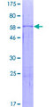 SMPD1 / Acid Sphingomyelinase Protein - 12.5% SDS-PAGE of human SMPD1 stained with Coomassie Blue